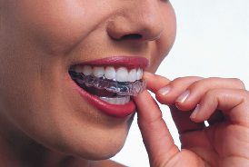 Invisalign for teens and adults